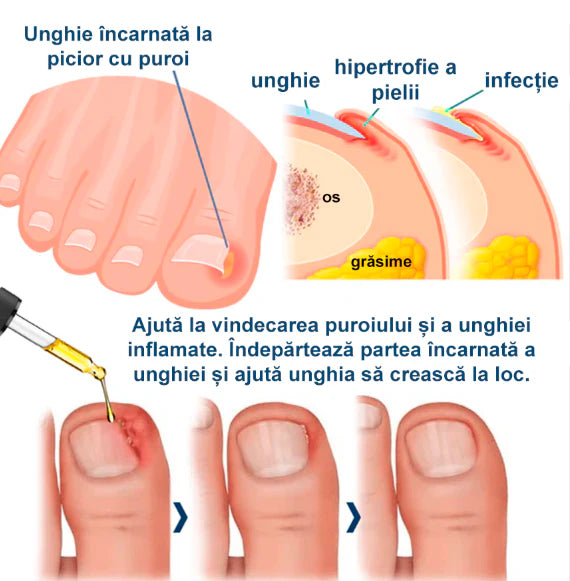 Uleiul ToenailPlus-Regenerarea unghiilor