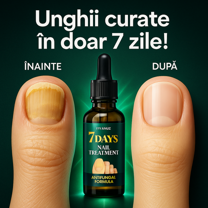 7DAYS® – Unghii curate, sănătoase și fără ciuperci în doar 7 zile!