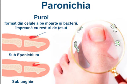 Uleiul ToenailPlus-Regenerarea unghiilor