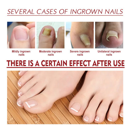 Uleiul ToenailPlus-Regenerarea unghiilor